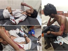 ABVP workers severely wounded in a murderous attack by SFI goons in Kerala