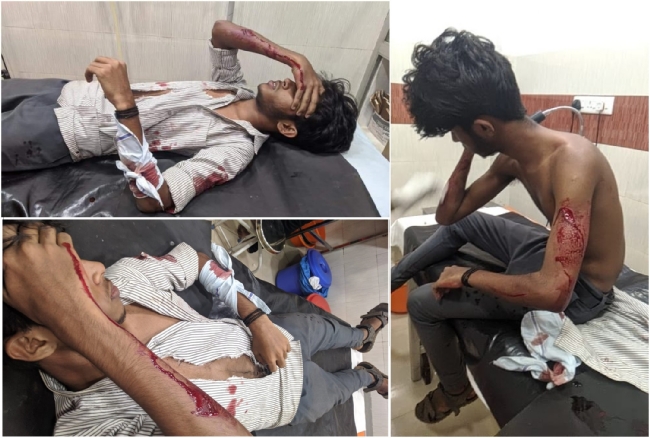 ABVP workers severely wounded in a murderous attack by SFI goons in Kerala