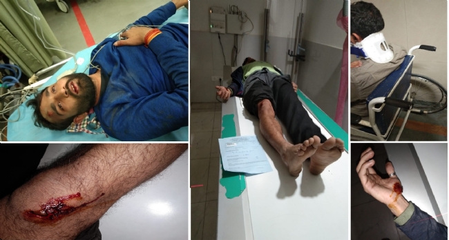 Common students and ABVP leaders were attacked in JNU