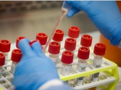 కోవిడ్-19 పరీక్ష అందరికీ ఎందుకు చేయడం లేదు?