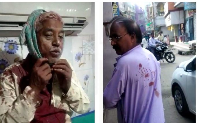 బీఎంఎస్ కార్యకర్తలపై టీఎంసీ గుండాల దాడి అమానుషం